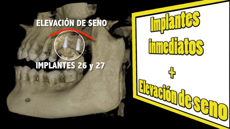 Elevaci&oacute;n de Calidad a trav&eacute;s de Soluciones T&eacute;cnicas Especializadas